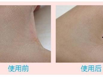 自体性欲,揭秘自我愉悦的奥秘